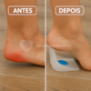 Calcanheira Vertical Siligel Protect – Alívio Imediato para Dor no Calcanhar